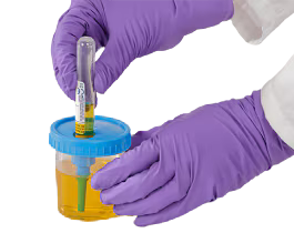 Sistema de recoleccion